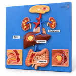 Metastatic Amoebiasis Model